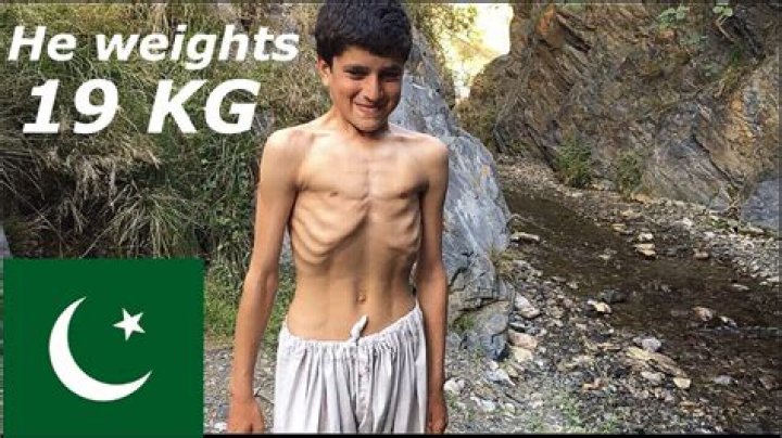 The Incredible Journey of the Skinniest Person in the World