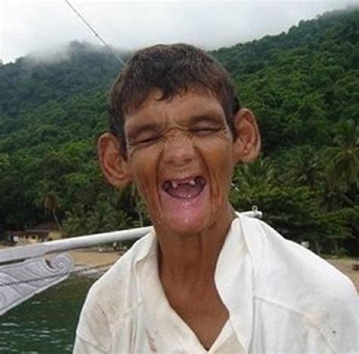 The Most Ugly Person in the World: A Deep Dive into Perceptions of Beauty