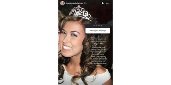 Tigerlily: The Transformation Journey of 90 Day Fiancé Before Plastic Surgery