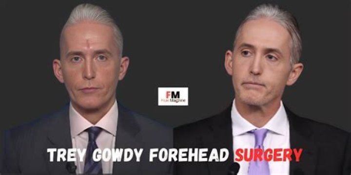 Unveiling the Truth Behind Trey Gowdy's Face Surgery