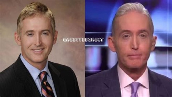 Trey Gowdy's Nose Transformation: A Closer Look at the Before and After