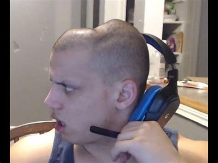 Tyler1 Head Dent: Understanding the Phenomenon and Its Impact