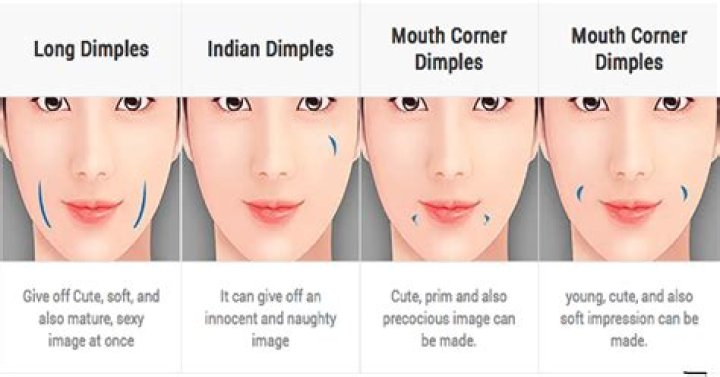 Unlock the Enigmatic Charms of Facial Dimples: Discover the Varieties