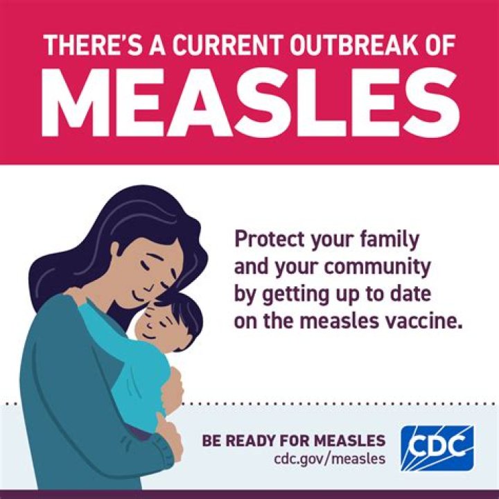 Understanding the Risks of Measles Exposure at Dulles Airport