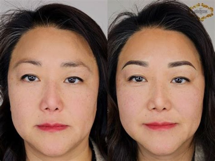 Understanding Uneven Brows: Causes, Solutions, and Expert Tips