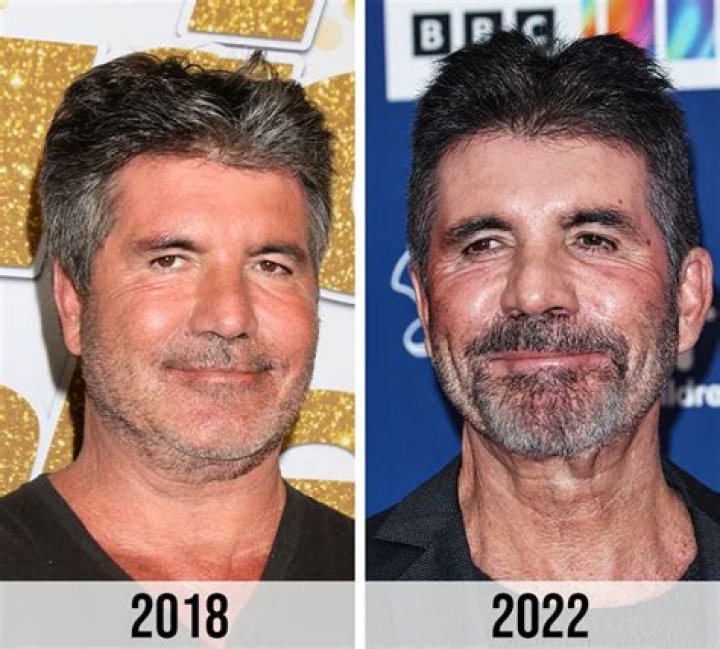 When Did Simon Cowell Die? A Deep Dive into His Life and Legacy