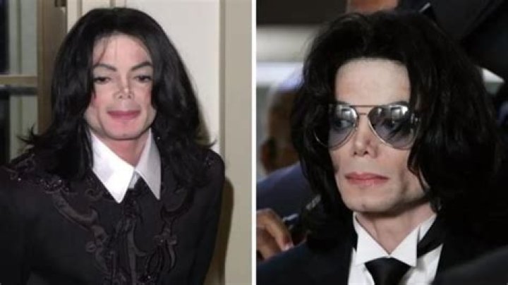 Unraveling the Mystery: What Did Michael Jackson Die From?