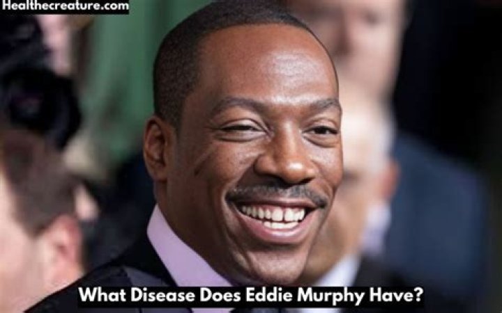 Unveiling Eddie Murphy's Health: What Disease Does Eddie Murphy Have?