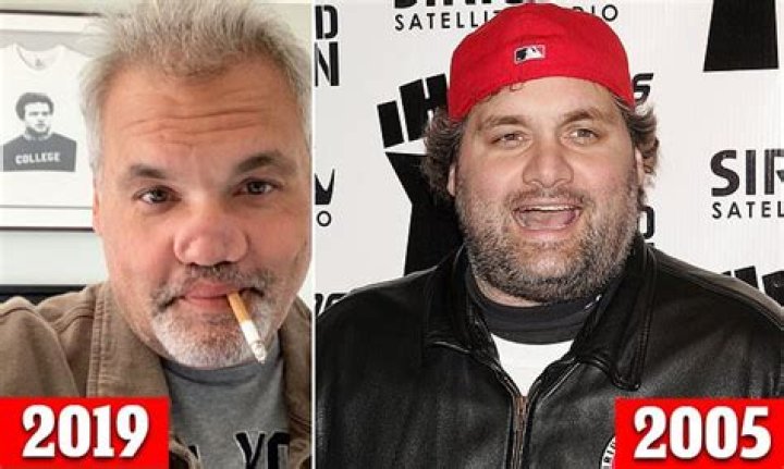 What Happened to Artie Lange's Nose: A Deep Dive into His Journey