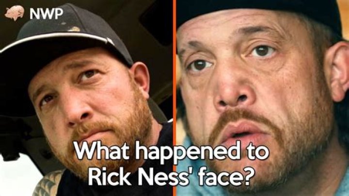 What Happened to Rick Ness' Nose? A Deep Dive into the Gold Rush Star's Journey