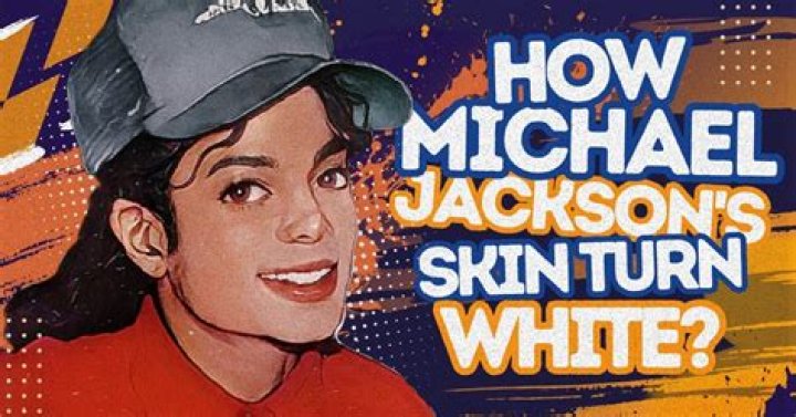 What Skin Condition Did Michael J Have? Unveiling the Truth Behind His Appearance