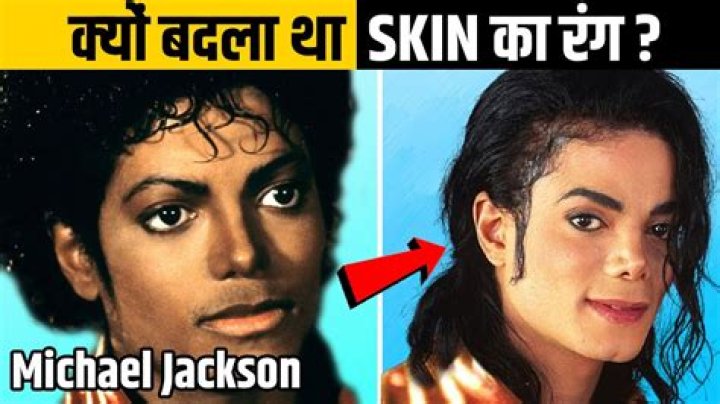The Unveiling of Michael Jackson's Skin Transformation: A Journey of Understanding